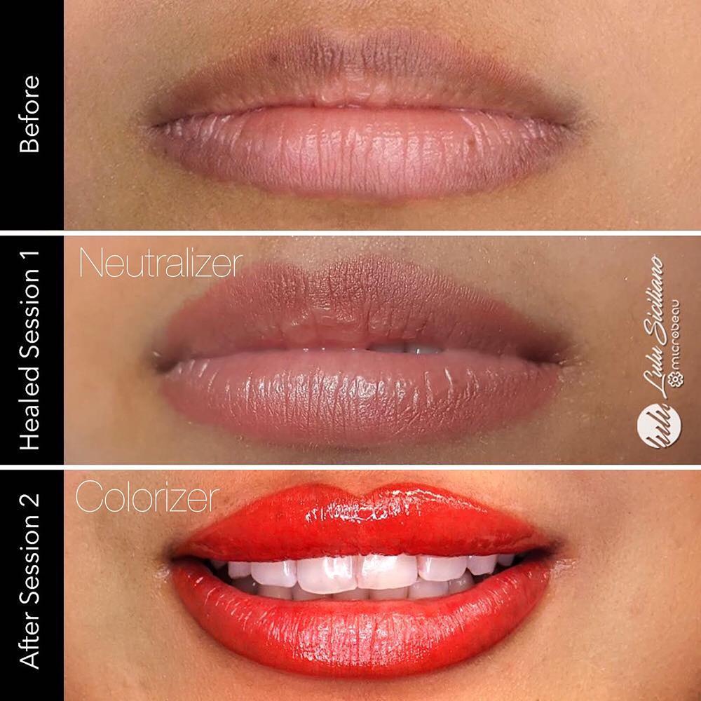 Perma Blend Evenflo Neutralizer Set